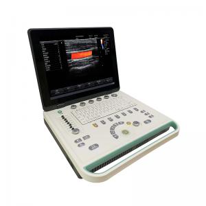 4D Color Doppler SS2